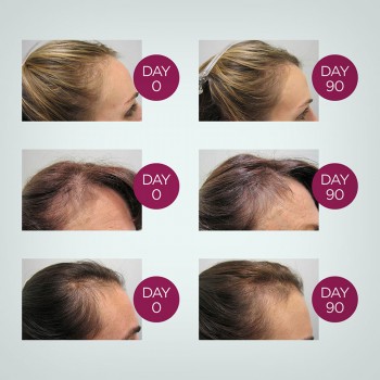 Viviscal Gorgeous Growth Elixir 50ml - eliksir za bujniju u gušću kosu za žene