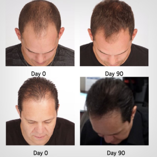 Viviscal Man Full Force shampoo 250ml - šampon za muškarce - Šampon za rast kose