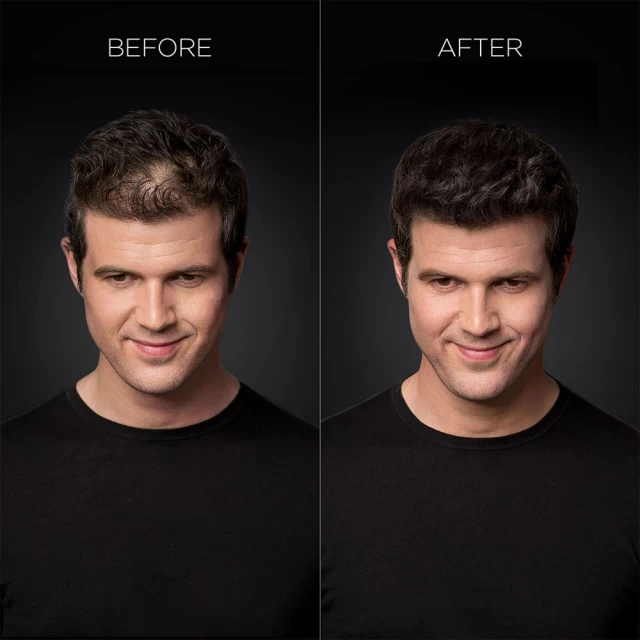 Toppik keratinska vlakna 12gr - Perut, Gubitak kose i Masnoća