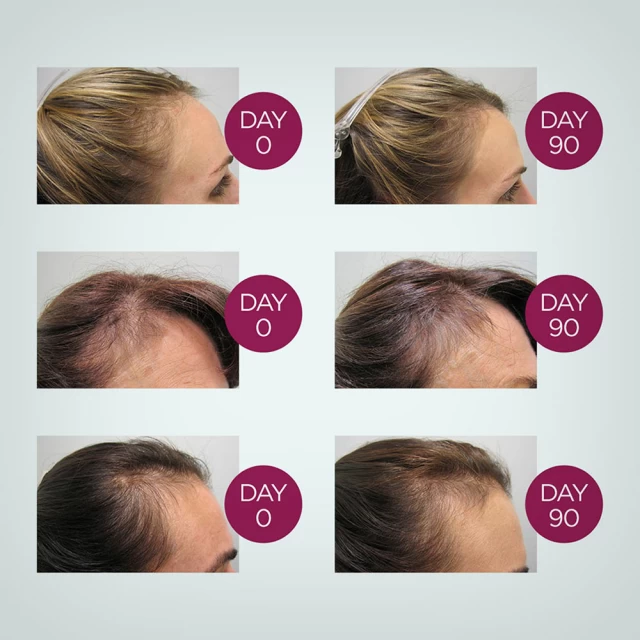 Viviscal Gorgeous Growth Densifying Conditioner 250ml - regenerator za žene - Preparati za rast kose