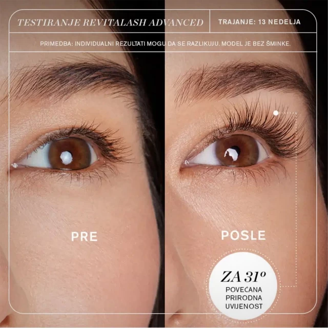 RevitaLash Advanced Eyelash Conditioner – Serum za rast i bujnije trepavice - Serumi za trepavice