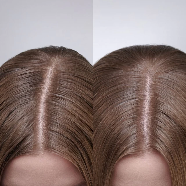 Moroccanoil Scalp treatment Dry No More 45ml - Dostava-kat